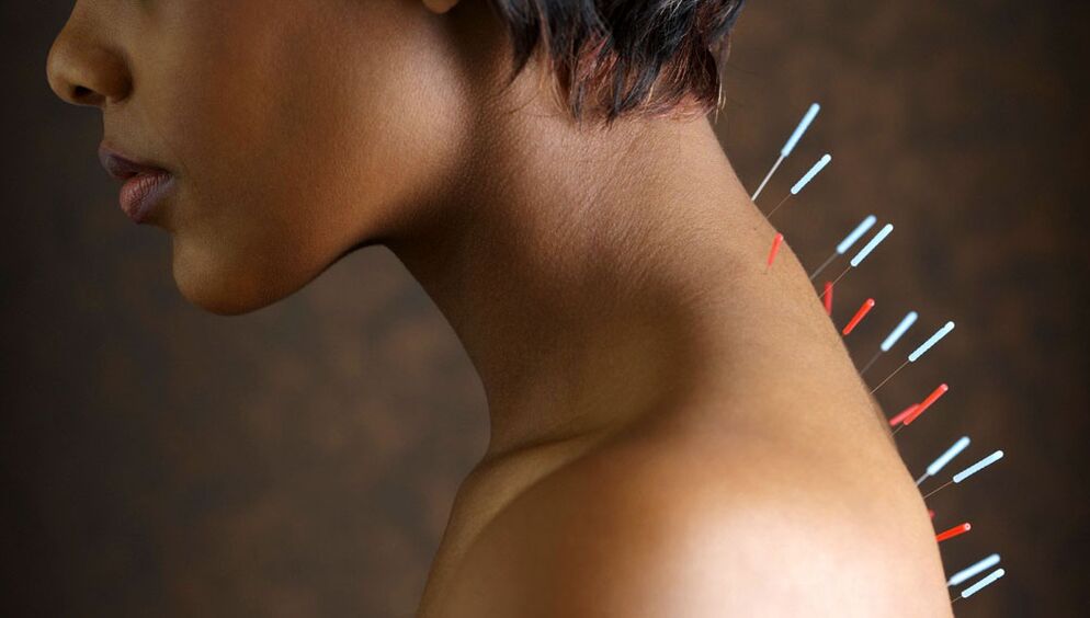 іглаўколванне з шыйным астэахандрозам