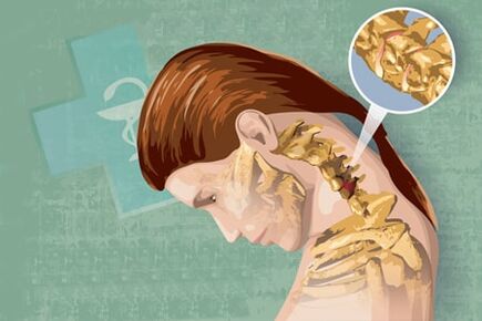 Рэфлекторныя сімптомы астэахандрозу